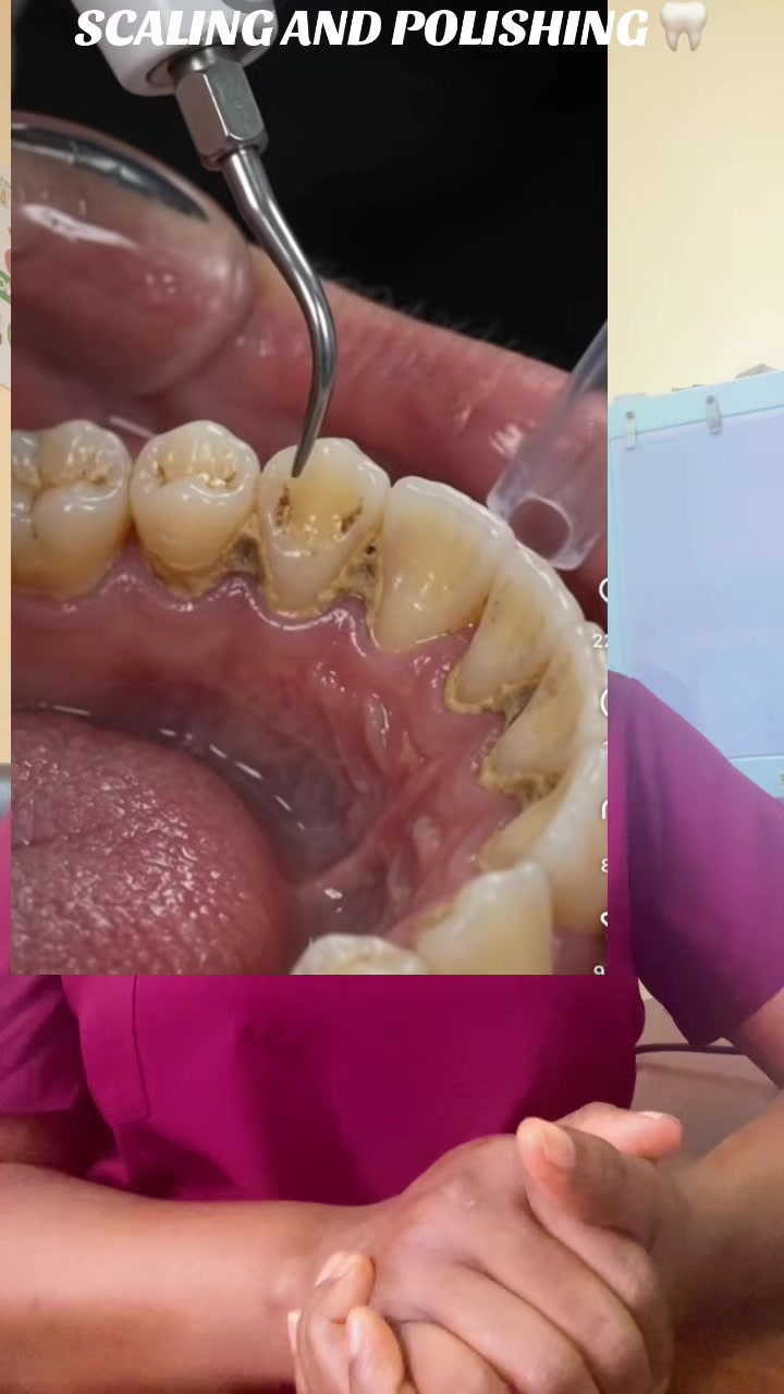 @NurseVivinelle_OralEducator🦷