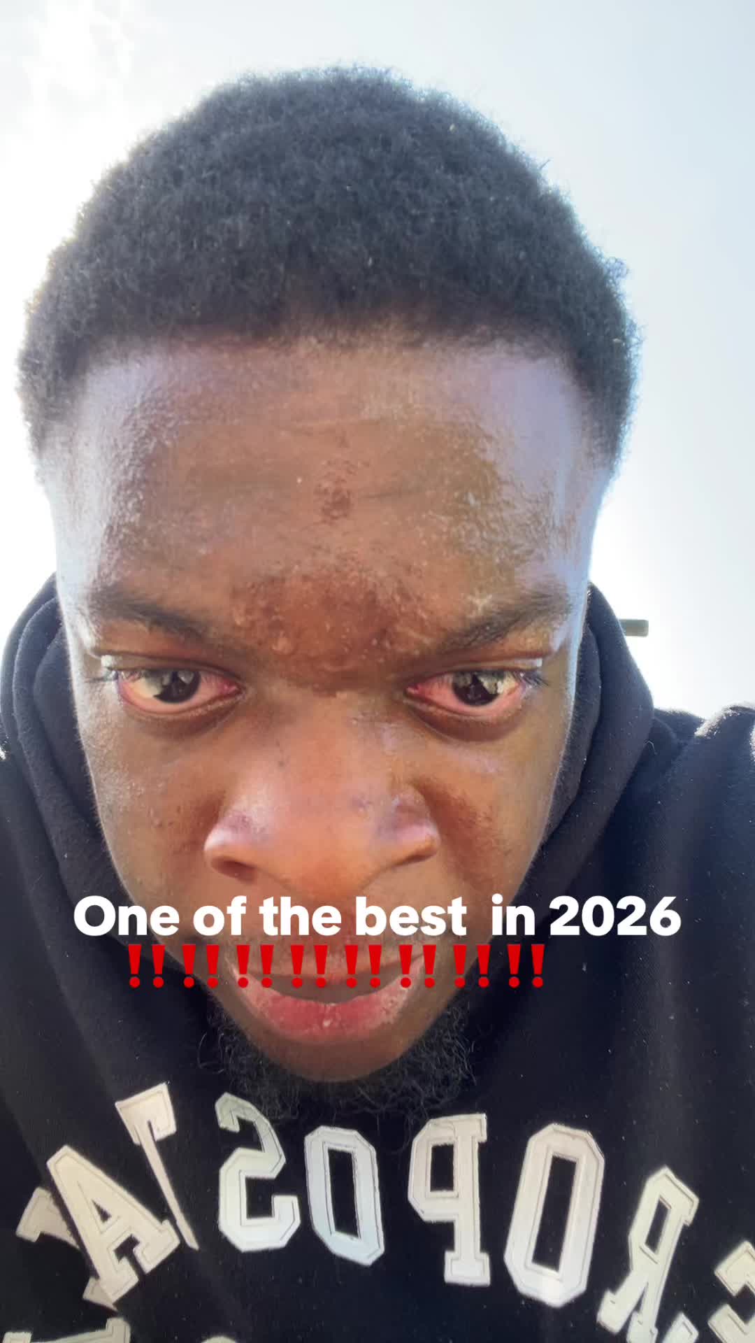 @Aj