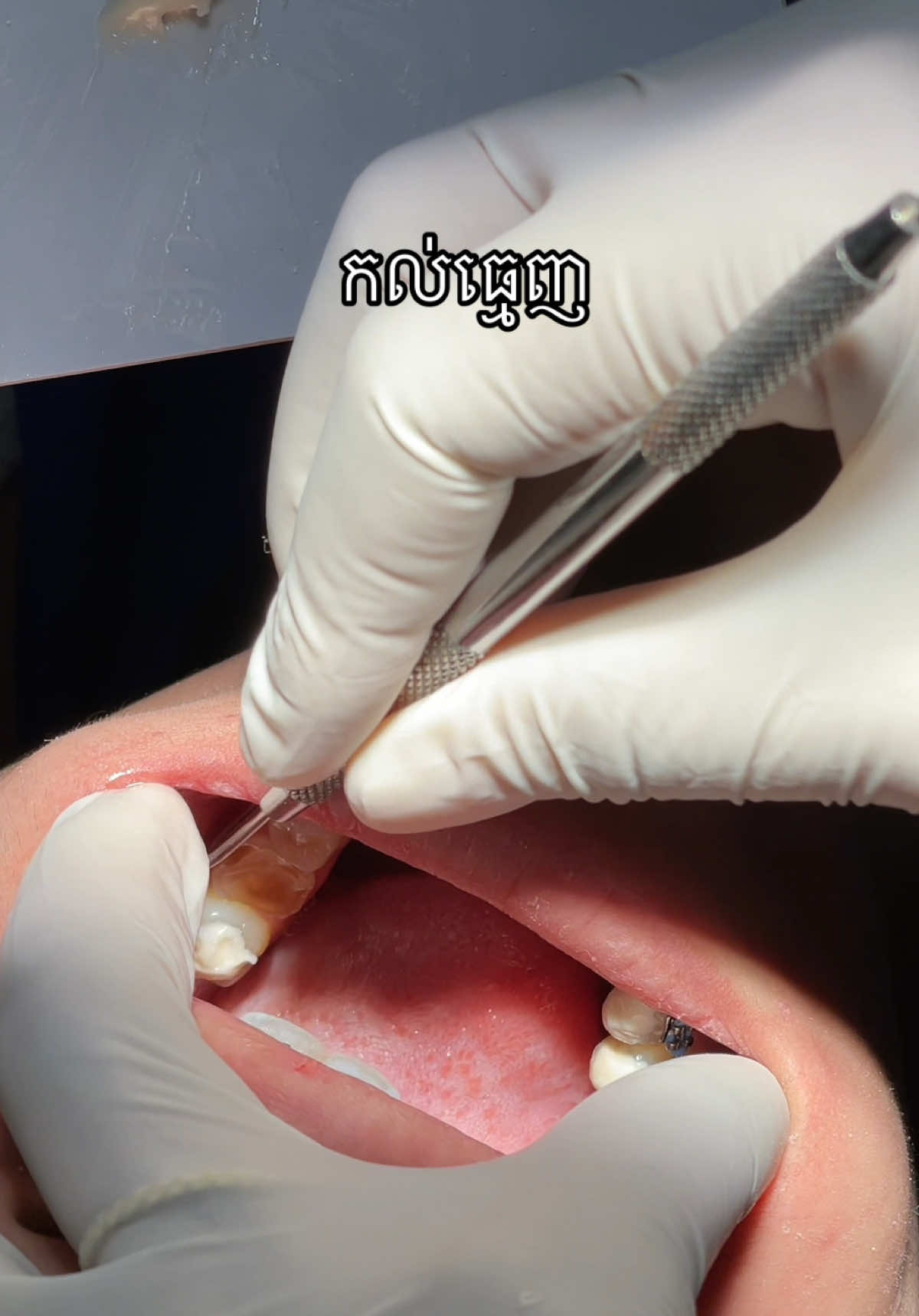 @BRIGHT SMILE DENTAL HOSPITAL