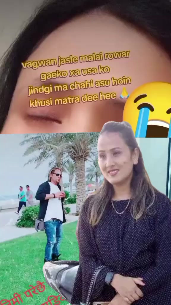 @Dimpal Katuwal591