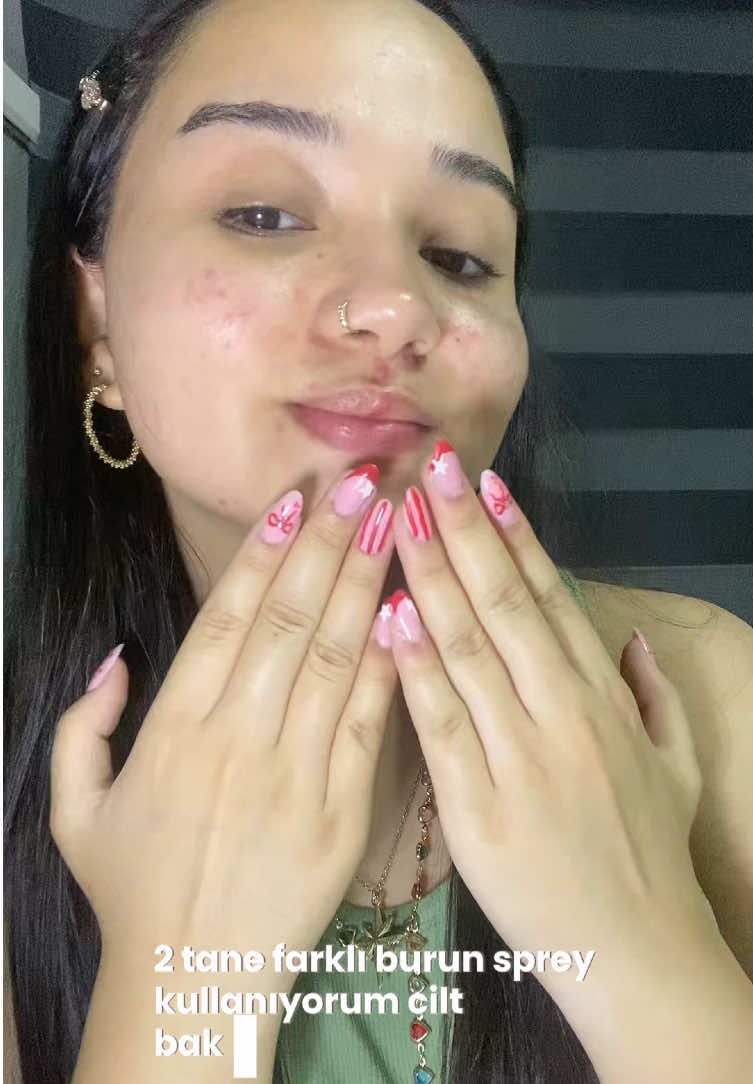 @ekin🎀