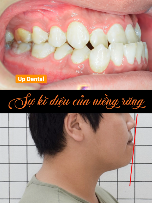 @Nha khoa niềng răng Up Dental