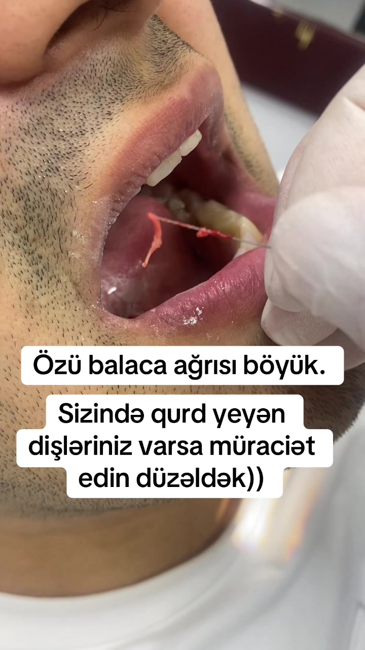 @dr_həmzət__