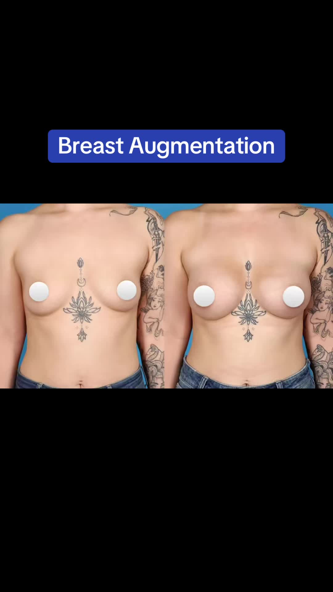 @Kelly Killeen, MD, FACS