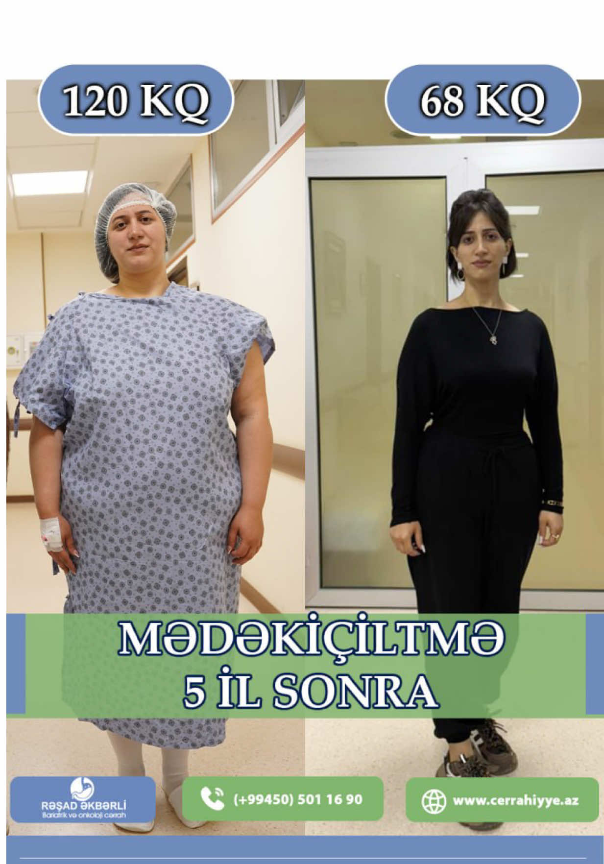 @&Uuml;mumi Cərrah Rəşad Əkbərli