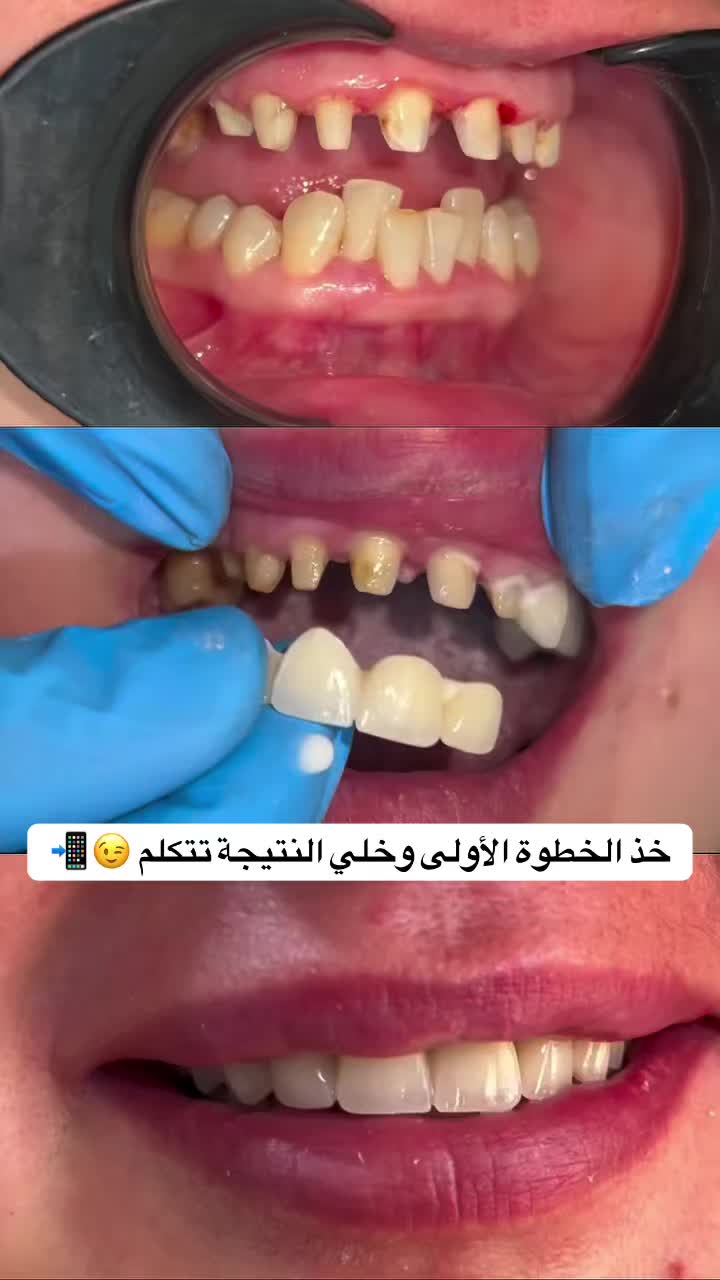 @brightsmileee1