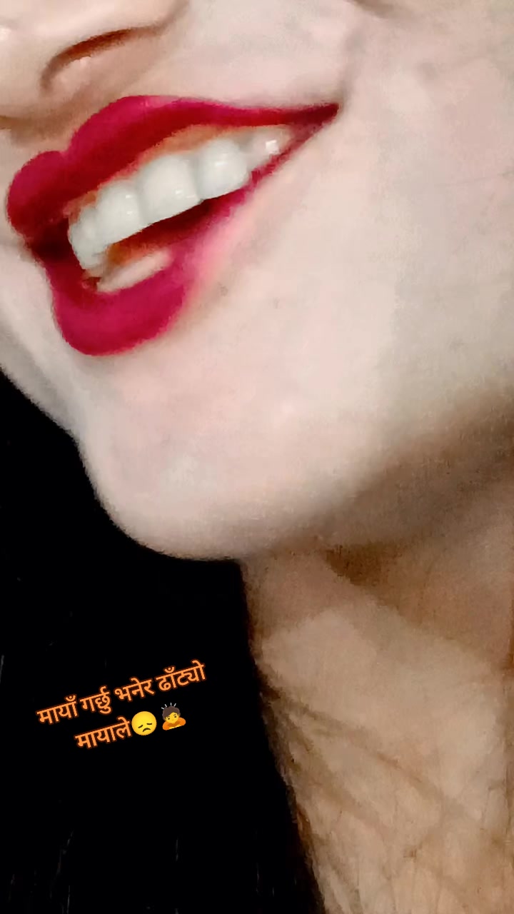 @Radhikabaral