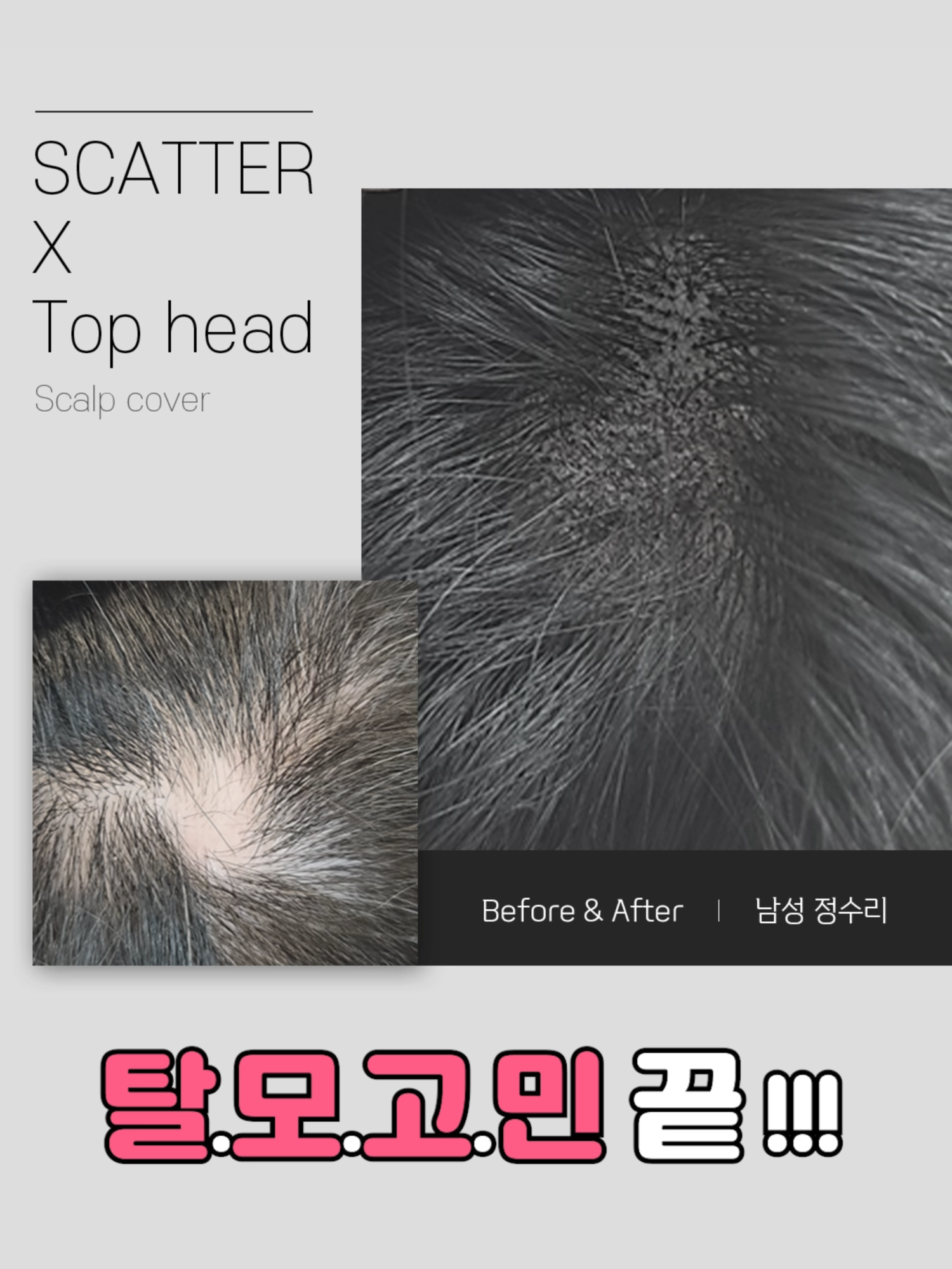 @EDDY BEAUTY KOREA