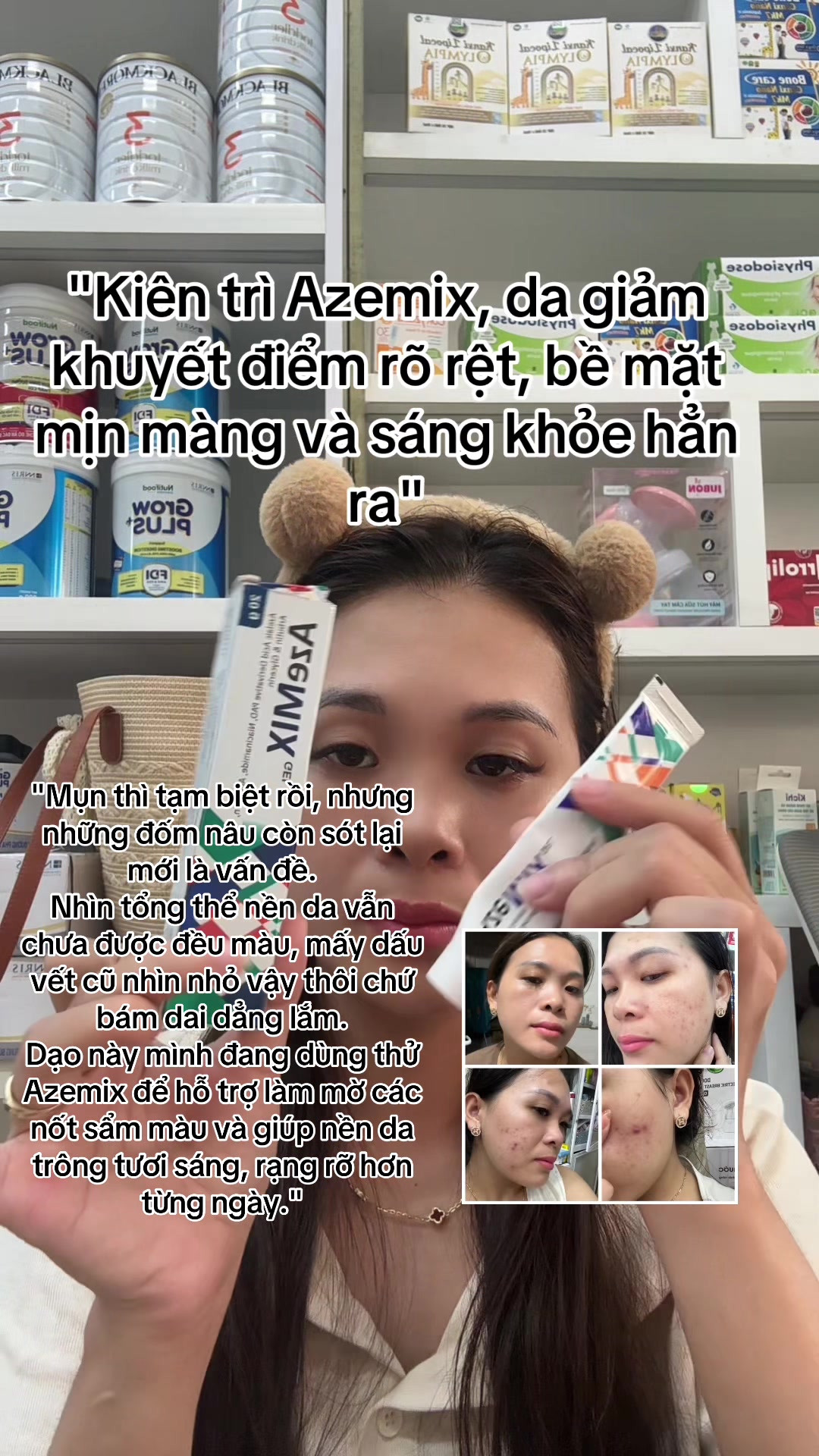 @Hoa Acne Skincare🌷