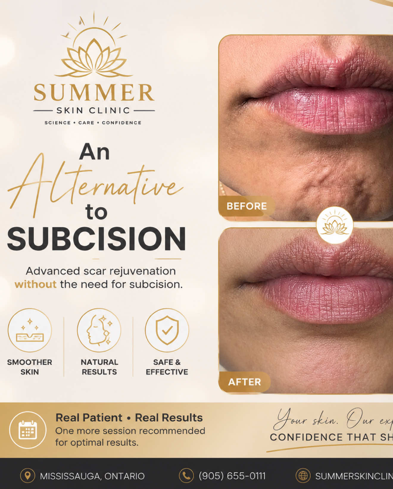 @Summer Skin Clinic | Toronto
