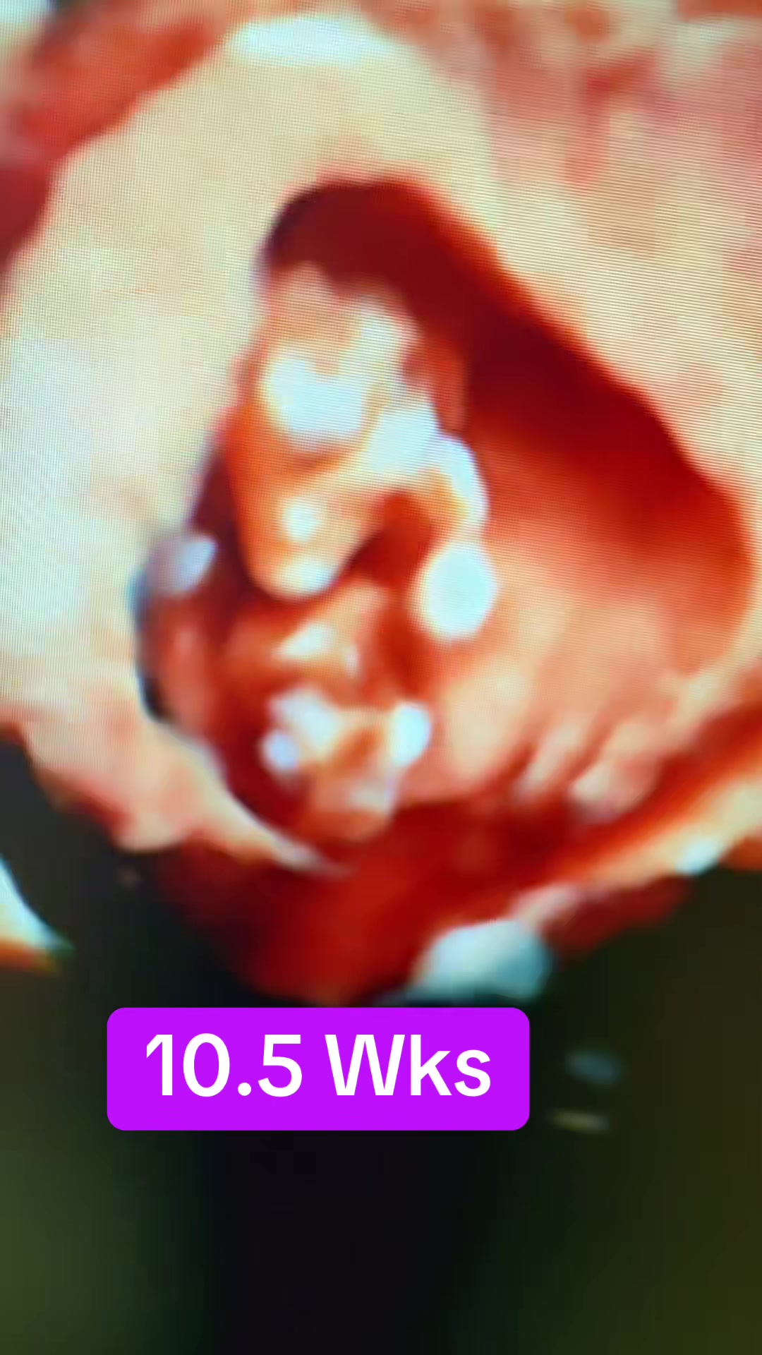 @PregnantSee Inc.