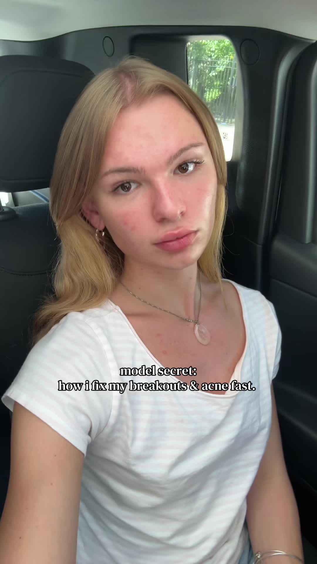 @jae matthiesen
