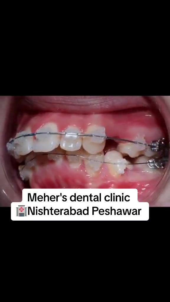 @dr_meher_official