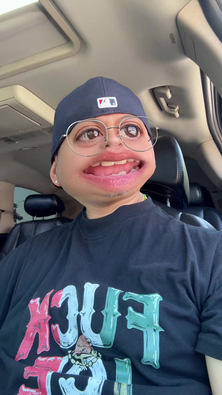 @MP