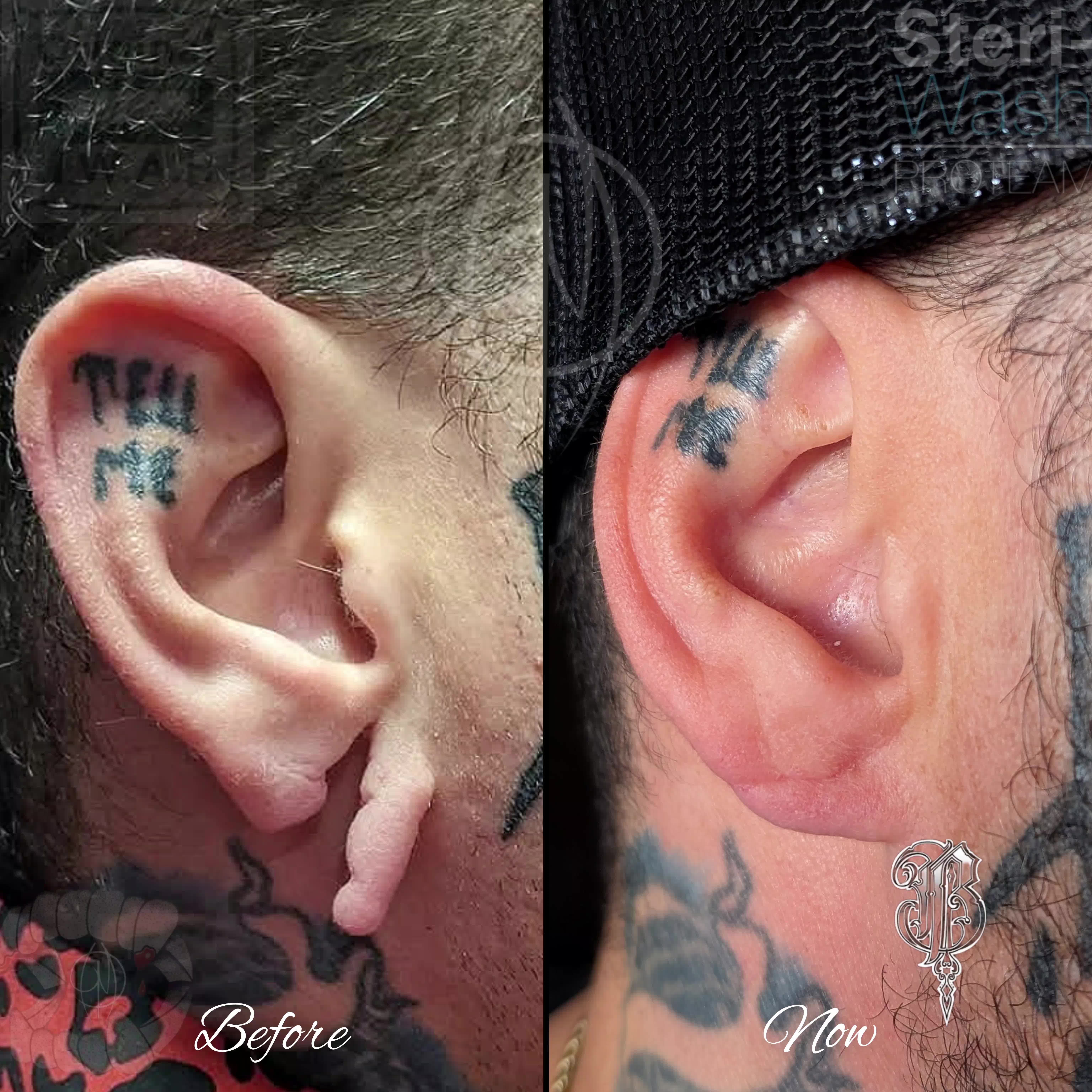 @Piercer Mike