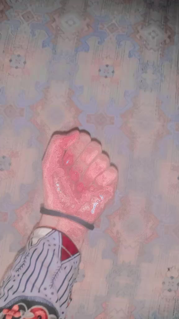 @๐๐๐๐๐๐ ๐๐๐๐๐ ๐๐ป