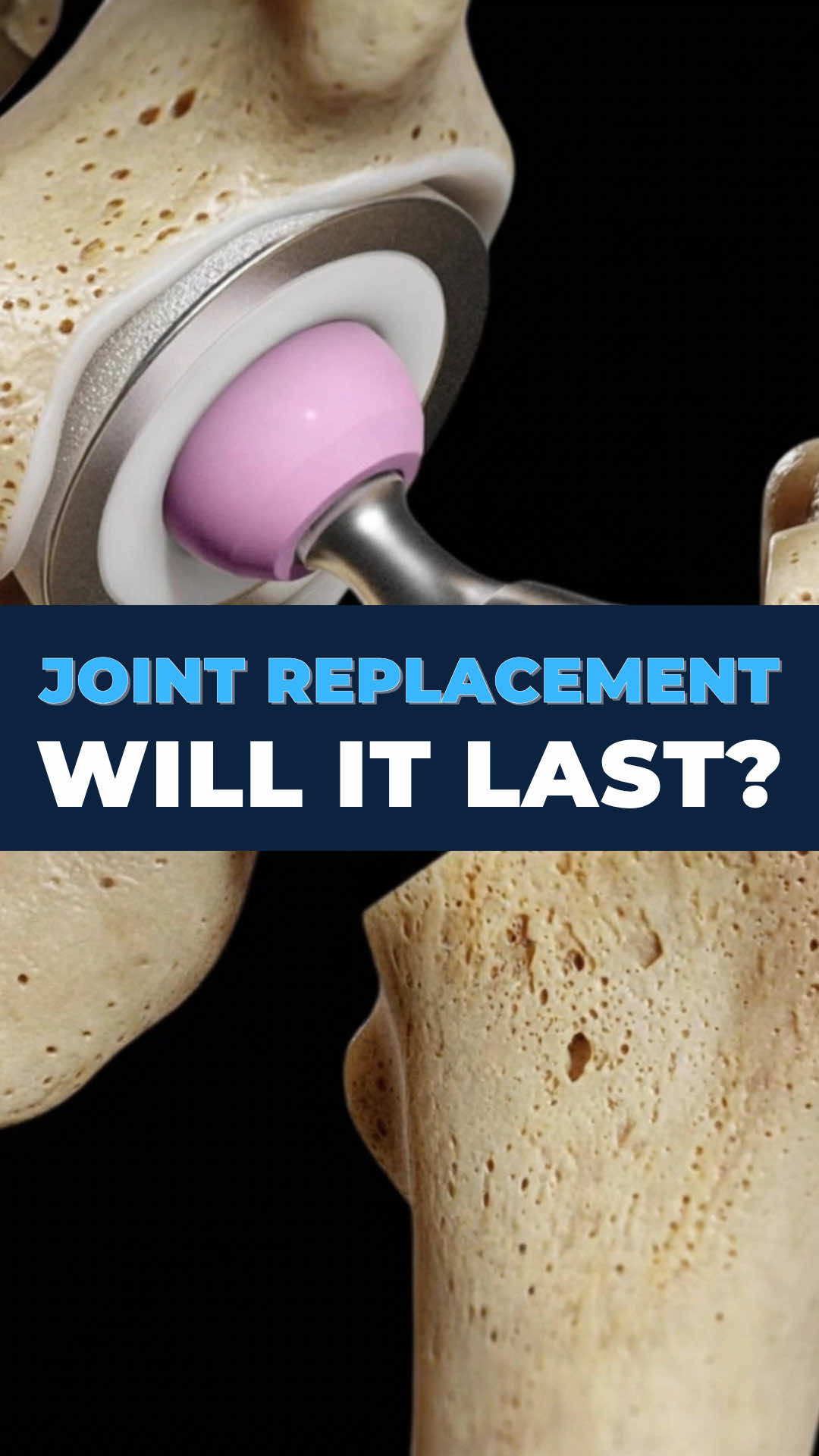 @Bone Doctor - Joint Pain MD