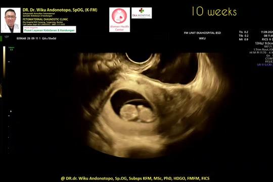 @DR.Dr.Wiku Andonotopo,SpOG KFM
