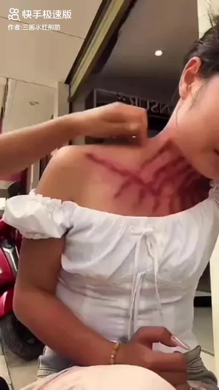 @thích cạo gió