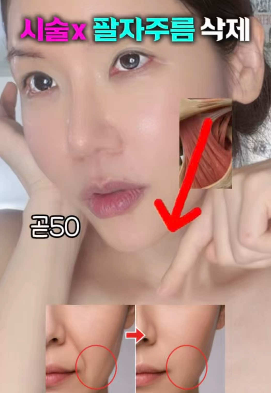@지나스 GINAS