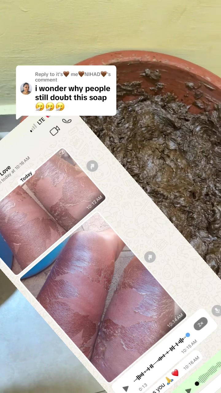 @@ Precious peeling soap