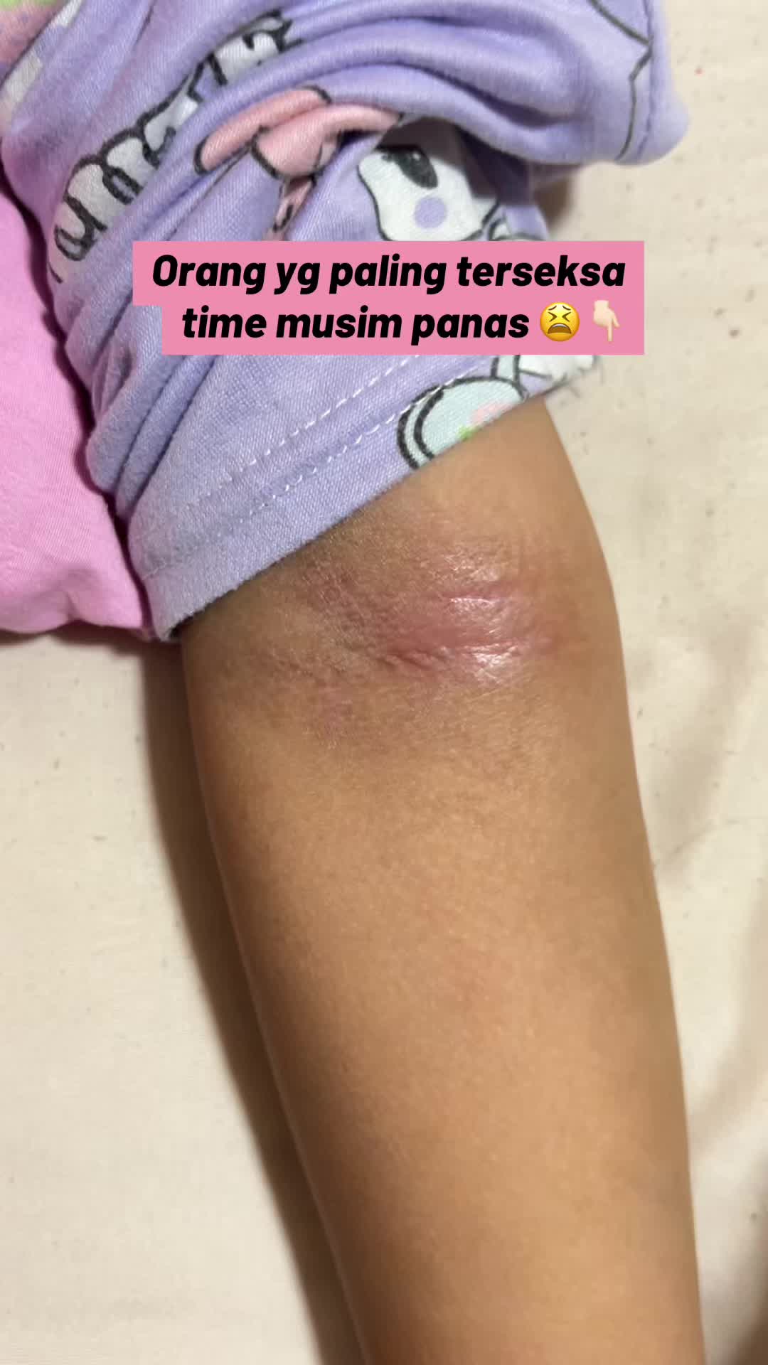 @Atirawaniiii