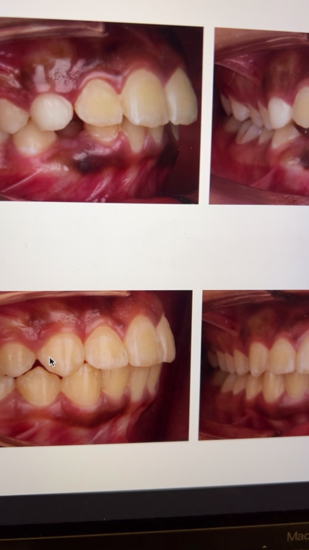@د. أسامة أحمد | تقويم أسنان