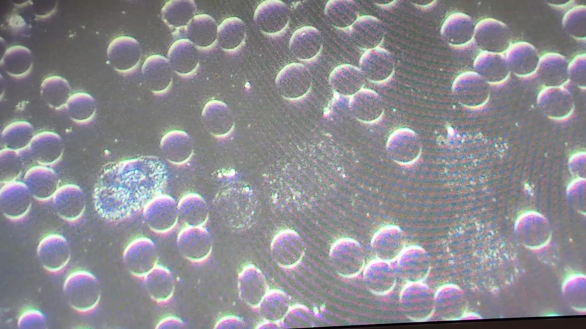 @HaemaFlow LiveBloodAnalysis