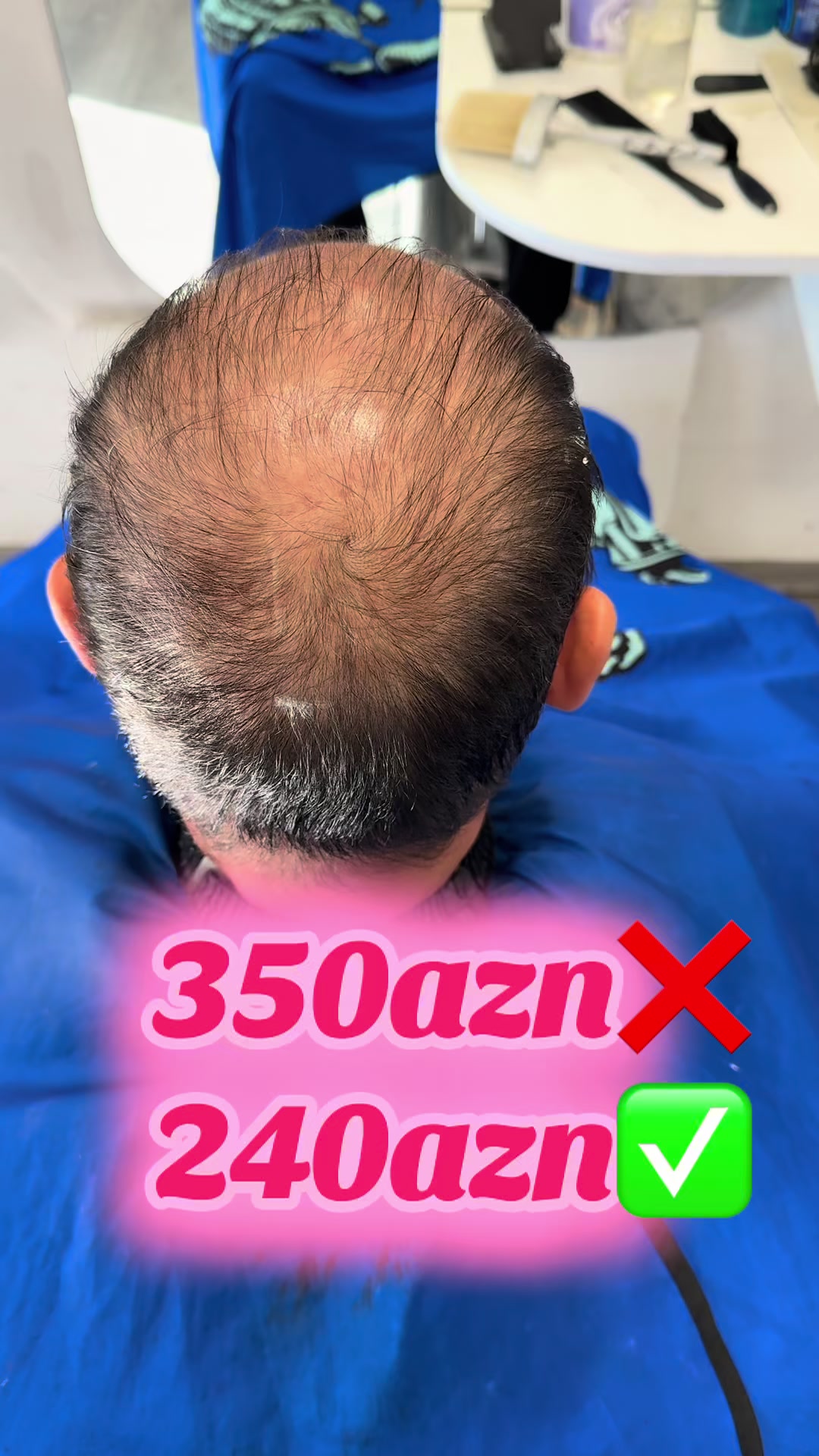 @cako ənucuz protez mərkəzi N:1