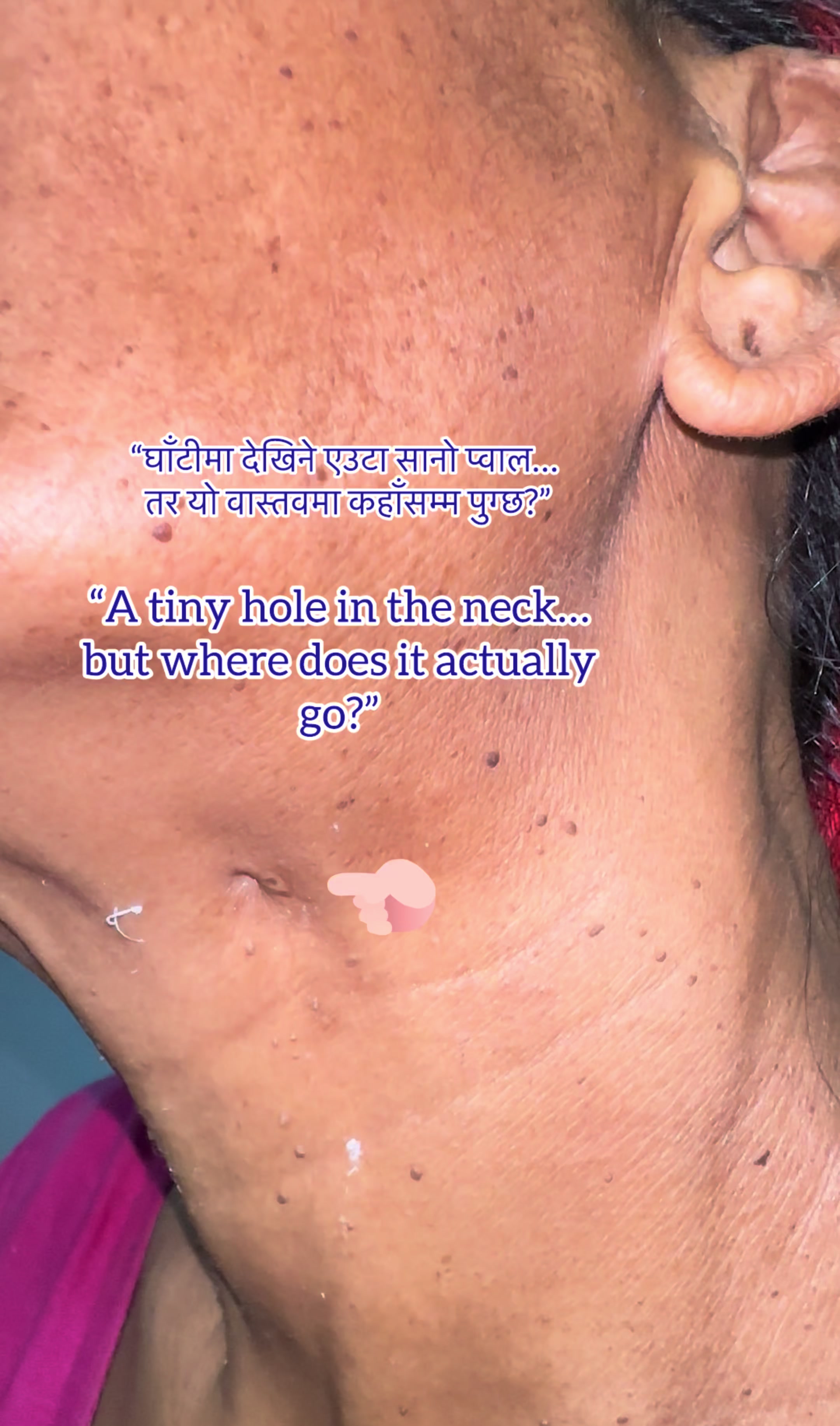 @DrPrakash Basnet