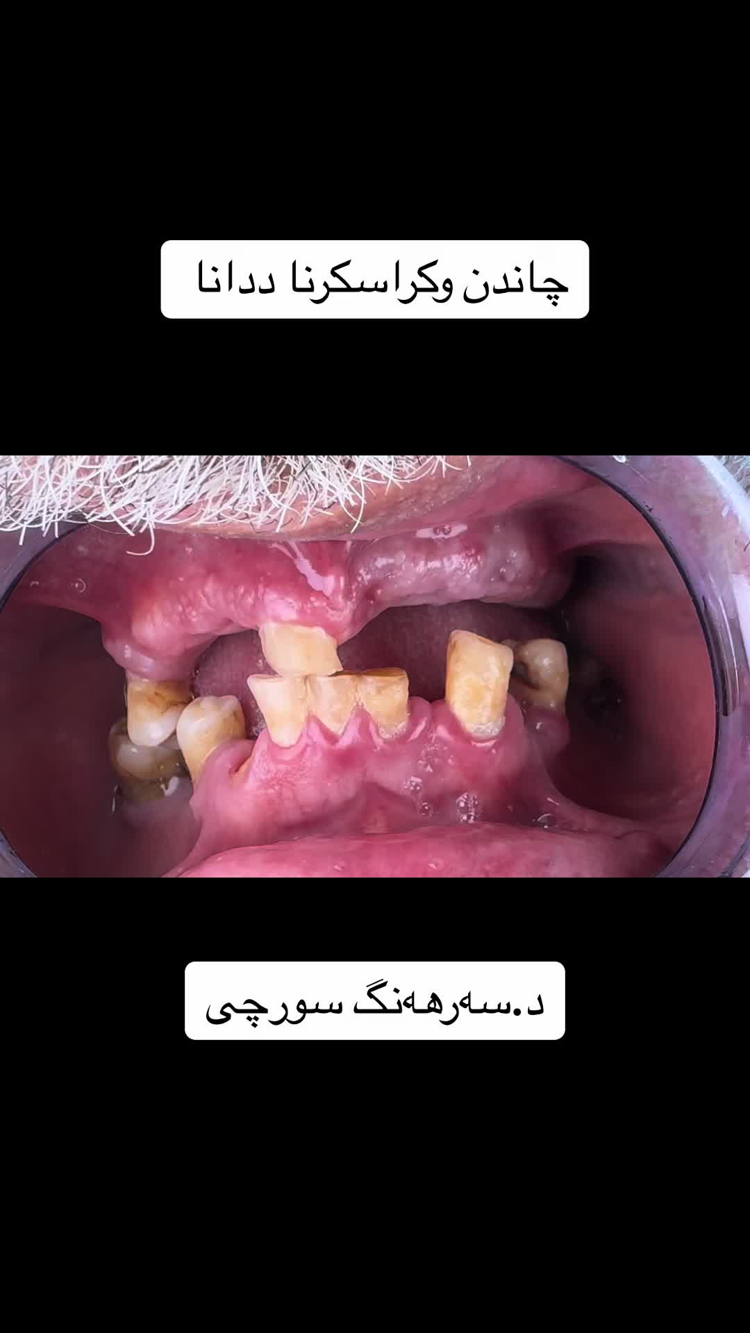 @Dr.Sarhang Surchi