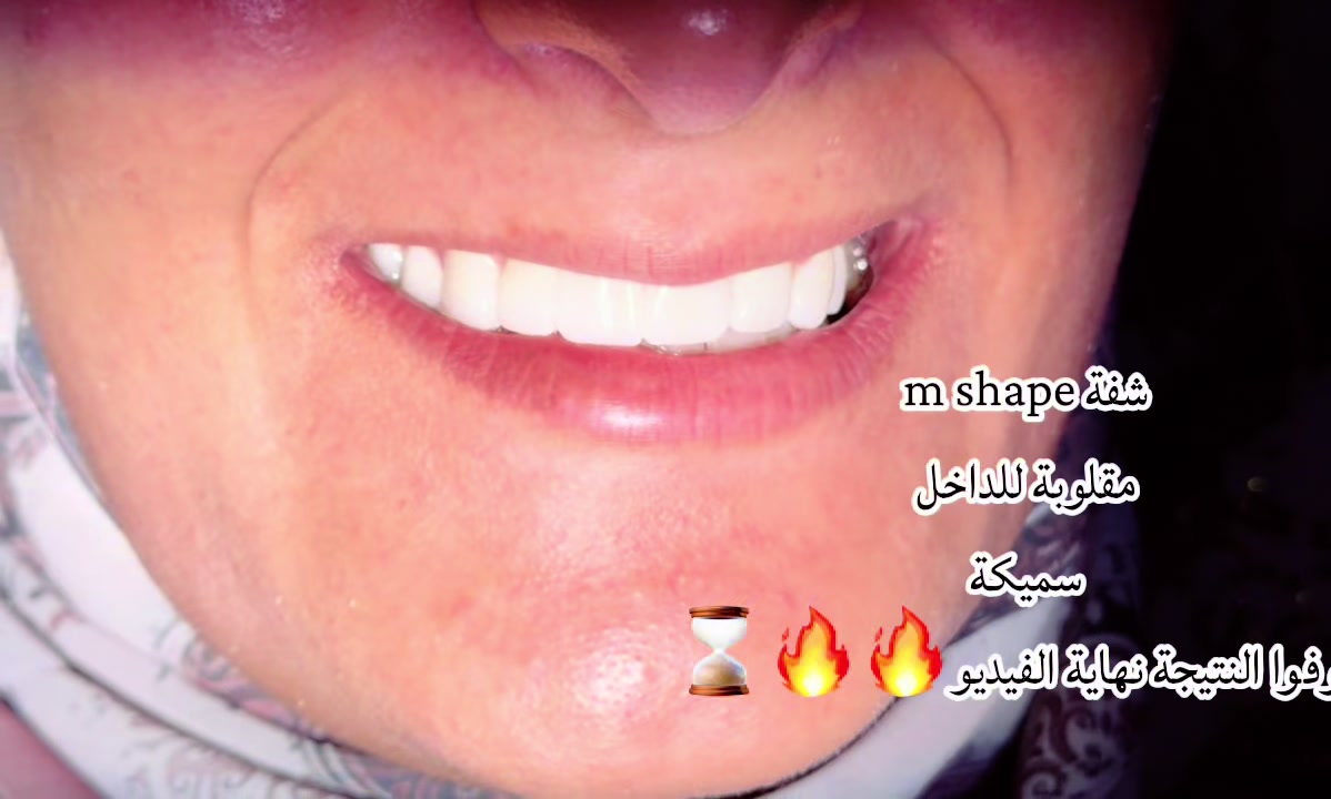 @Drhuda98