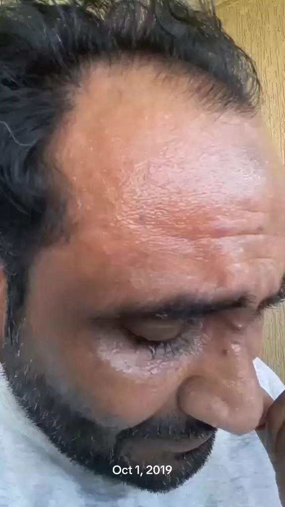 @BABA