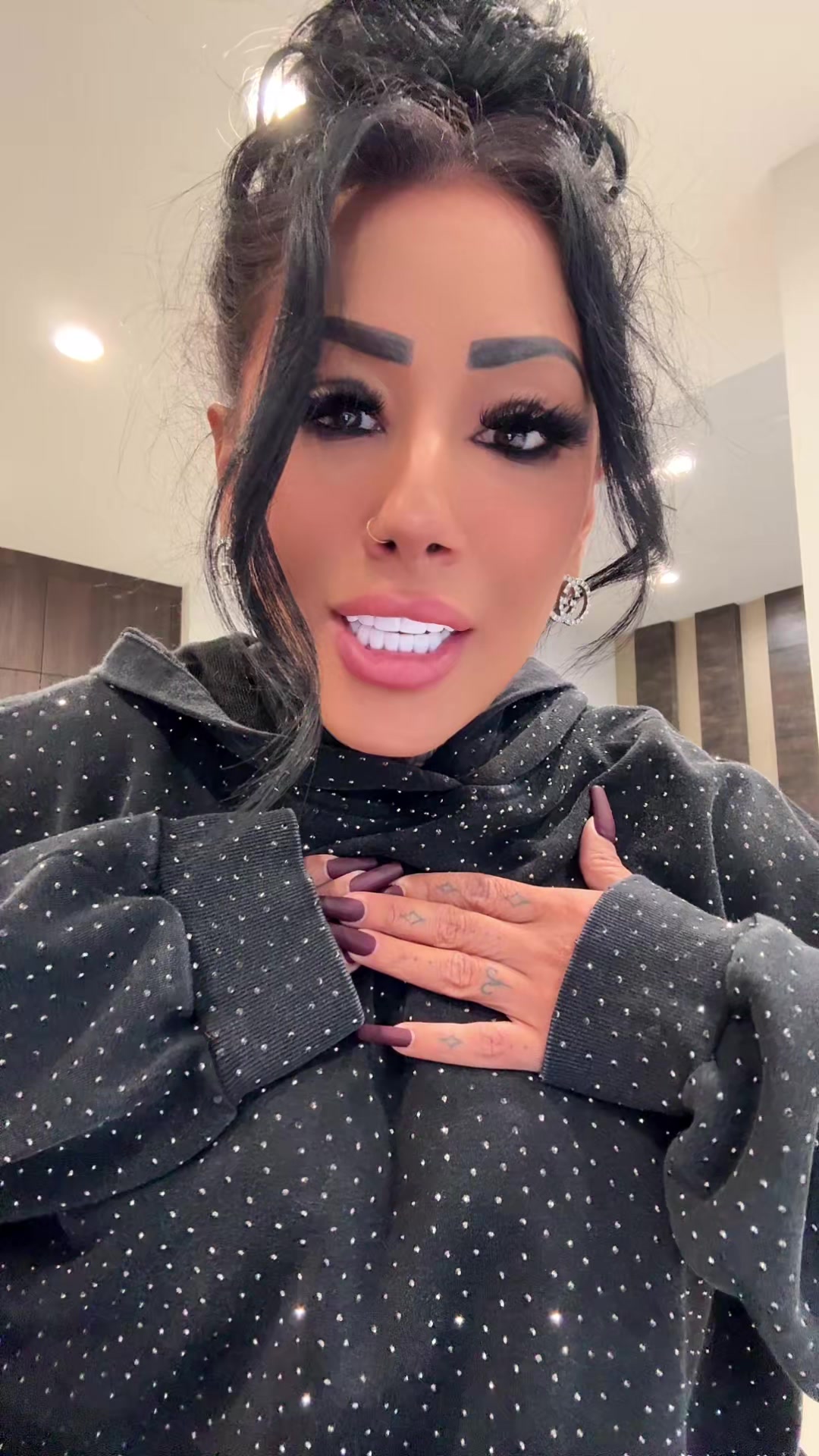 @Lyss
