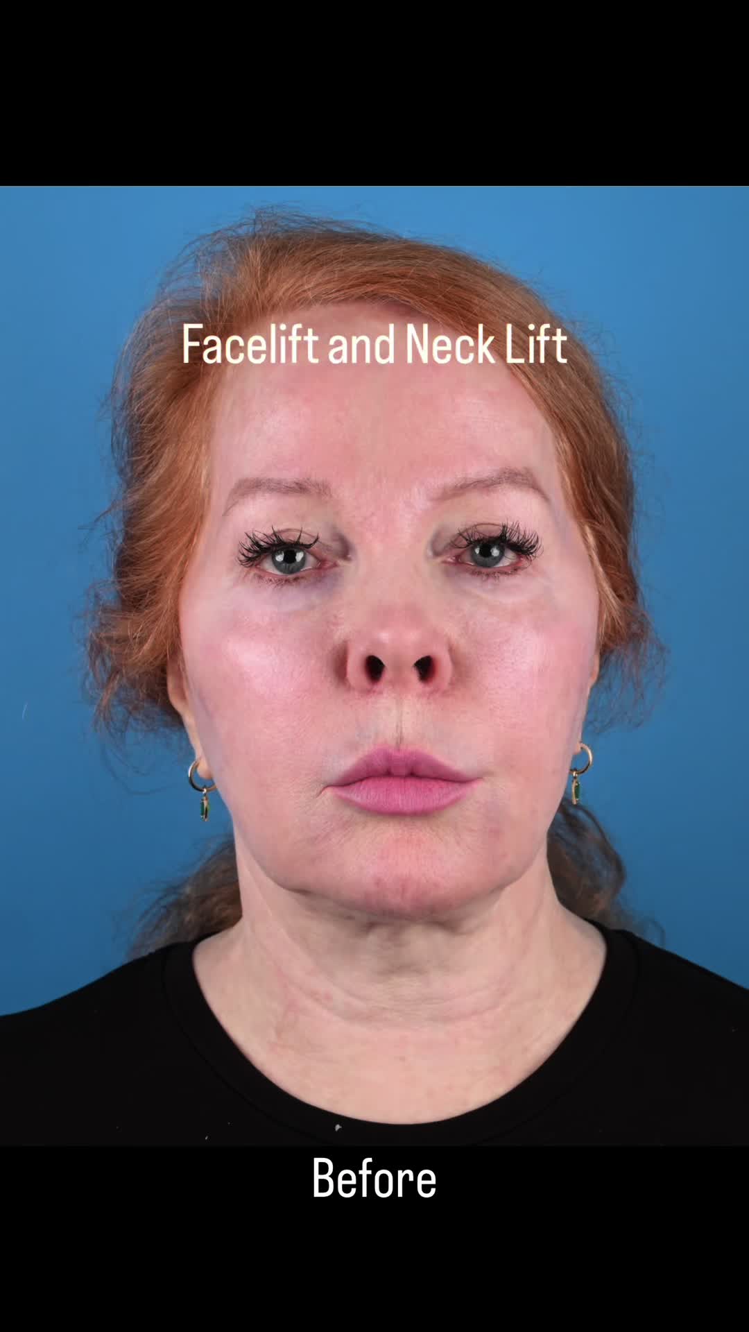 @Dr. Parit Patel, MD