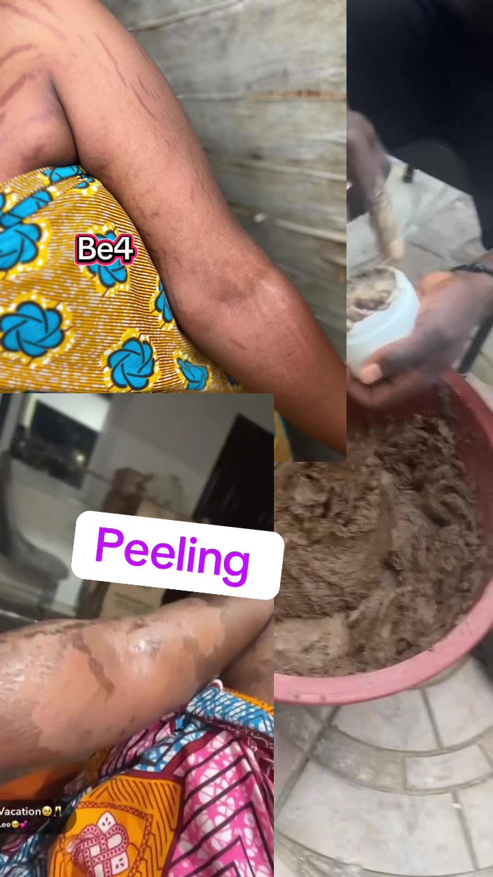 @@ Precious peeling soap