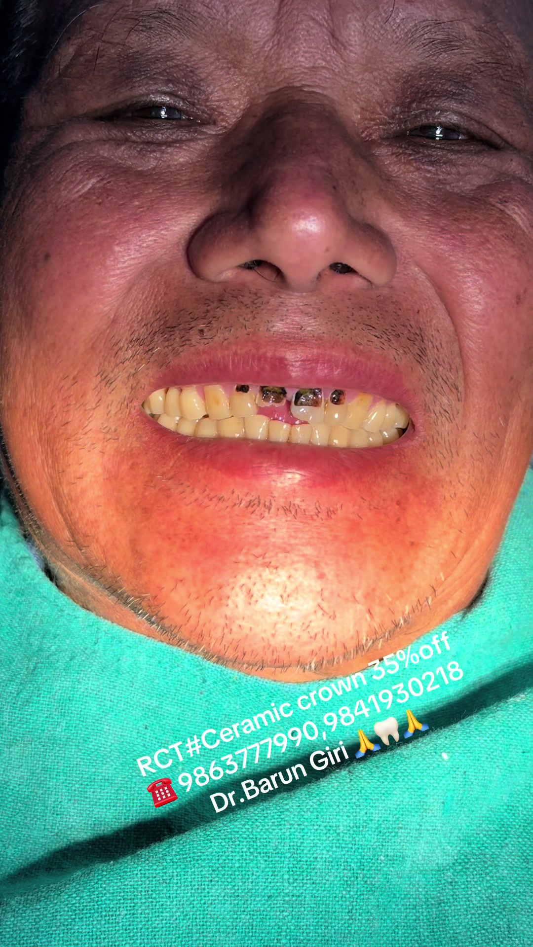 @Unique dental clinic Chabahil