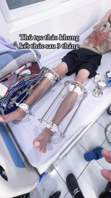 @K&eacute;o d&agrave;i ch&acirc;n TPHCM