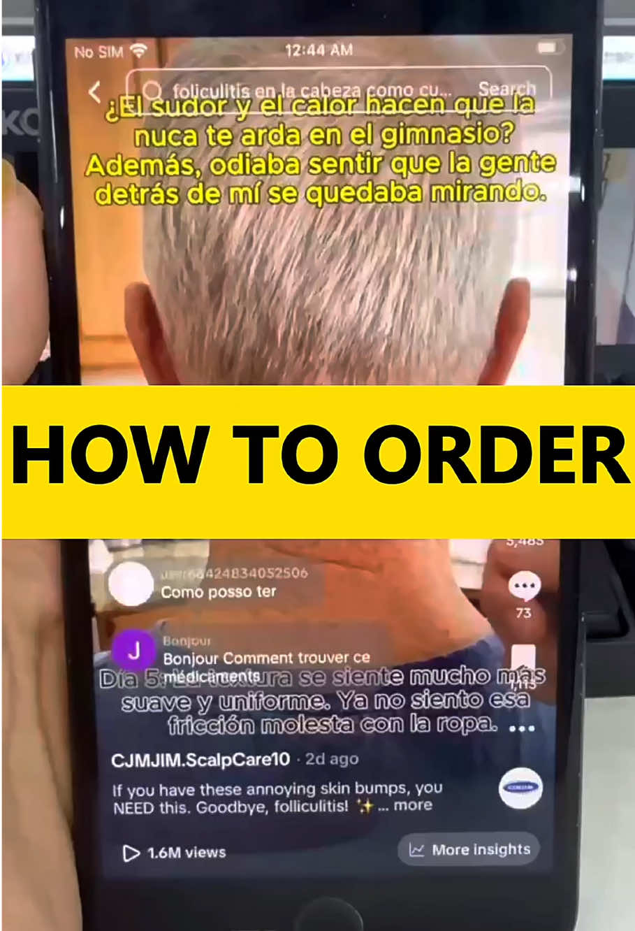 @CJMJIM.ScalpCare10