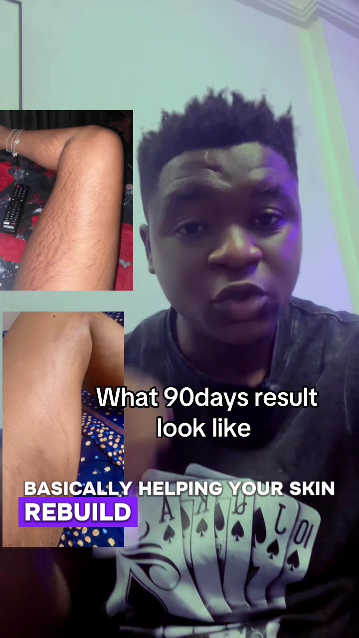 @Radiant skin