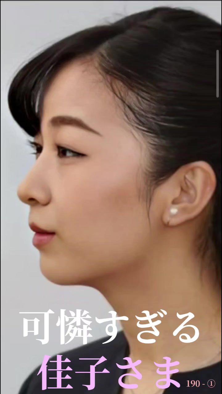 @Bijinsugiru3333