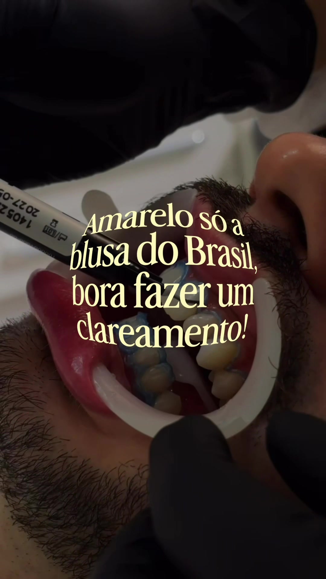 @Edinei Dias