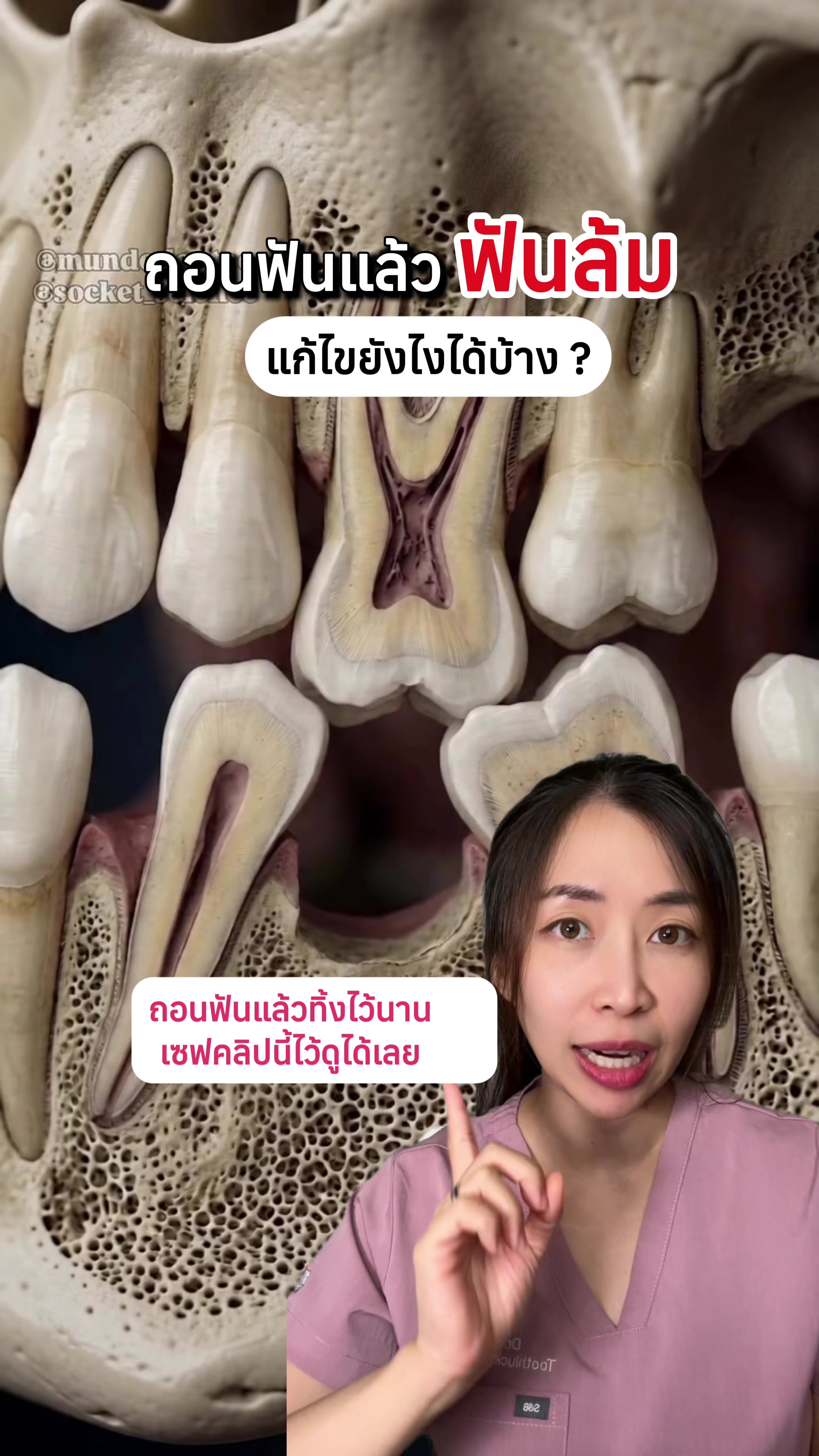 @ณัฐคุณ (Nuttakul Dent) 🦷