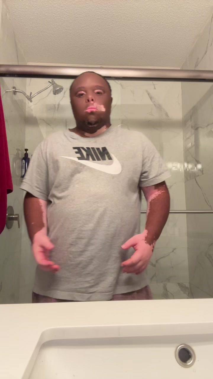 @Tre