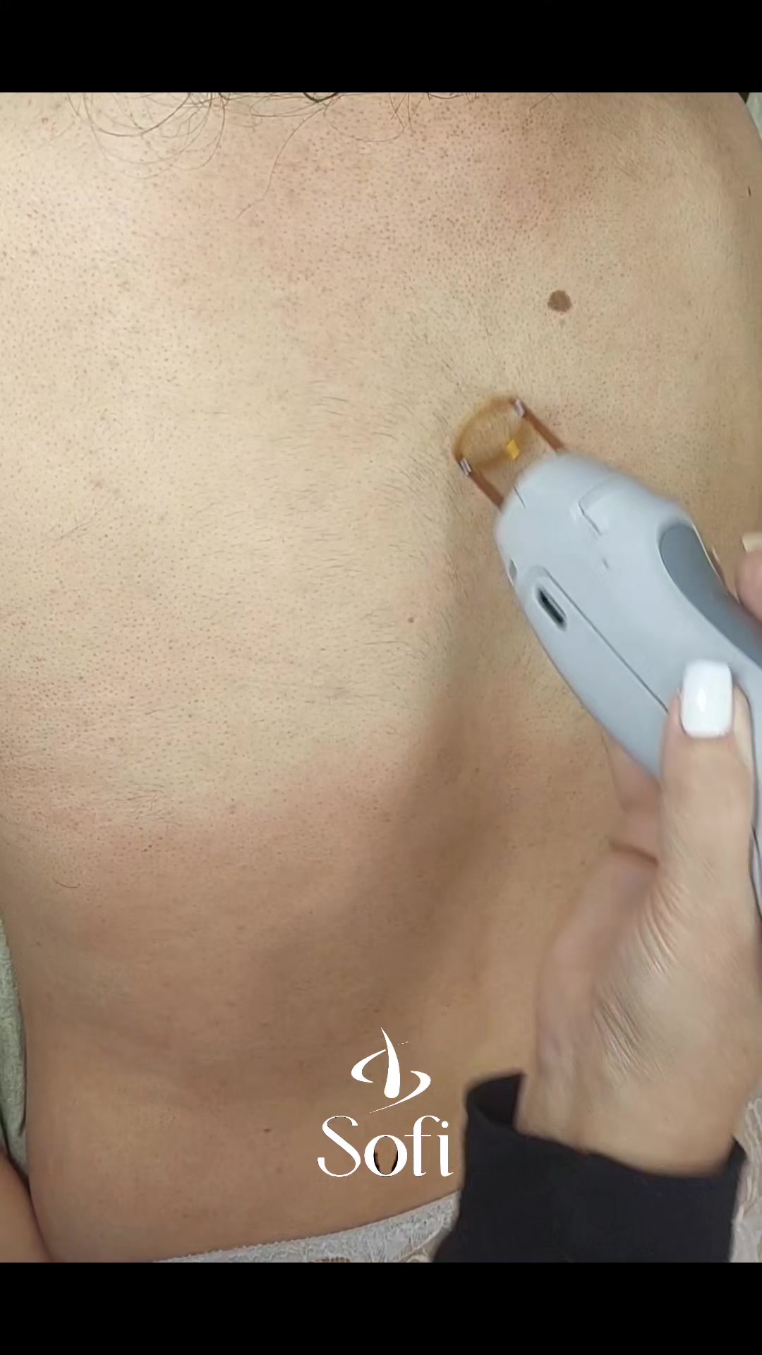 @𝑺𝒐𝒇𝒊 𝑳𝒂𝒛𝒆𝒓✨️