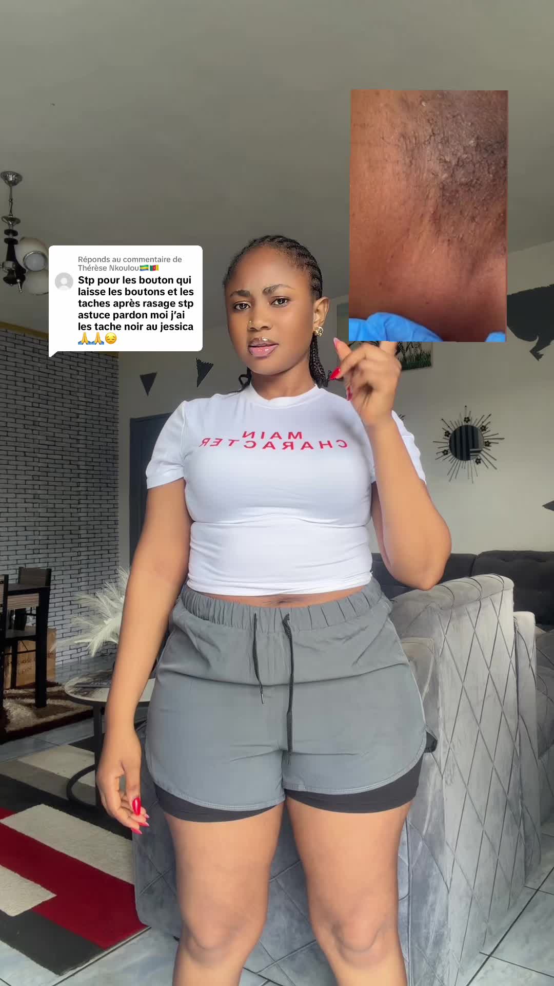 @Blanca✨🇨🇲