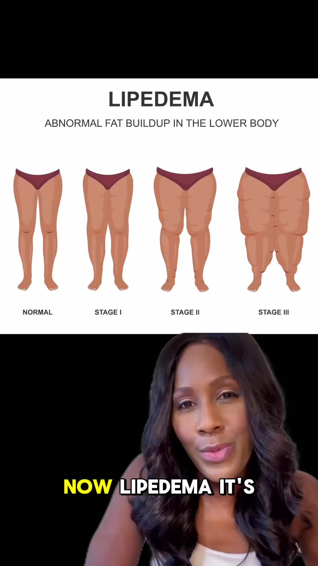 @DrJenCaudle