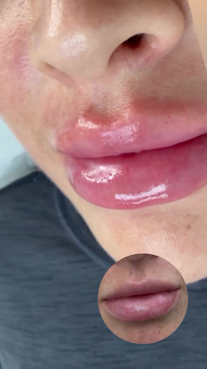 @LSSH