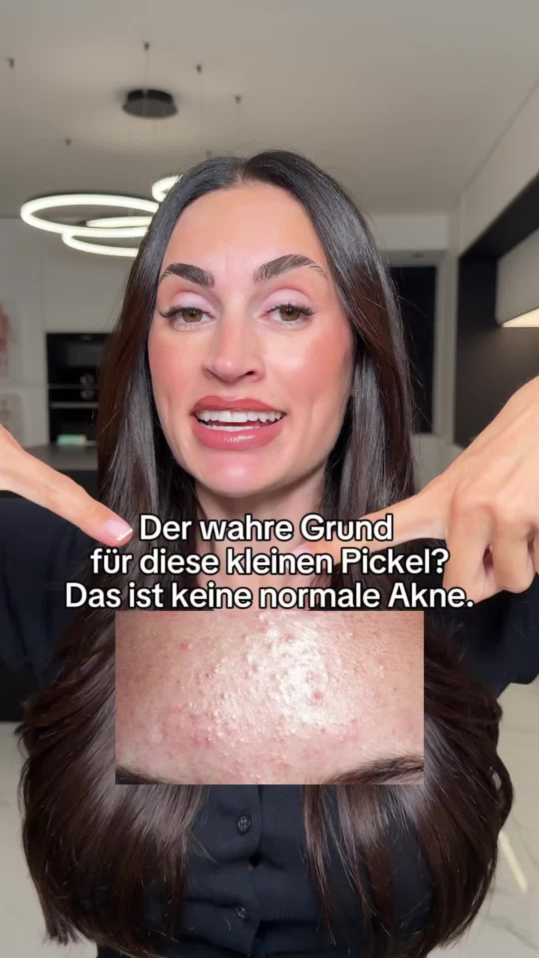 @Melissa | BEAUTYEXPERT