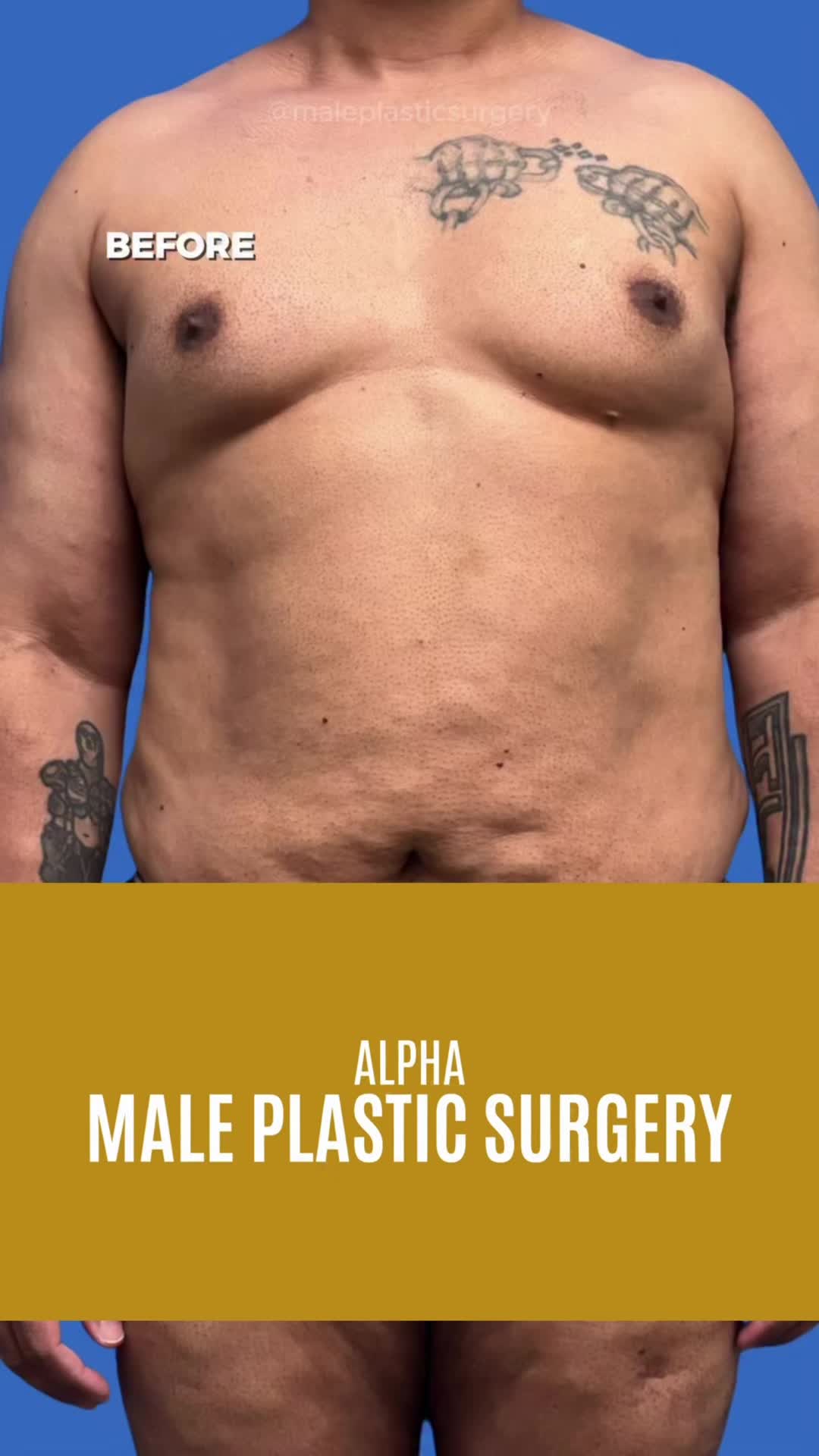 @mensplasticsurgery
